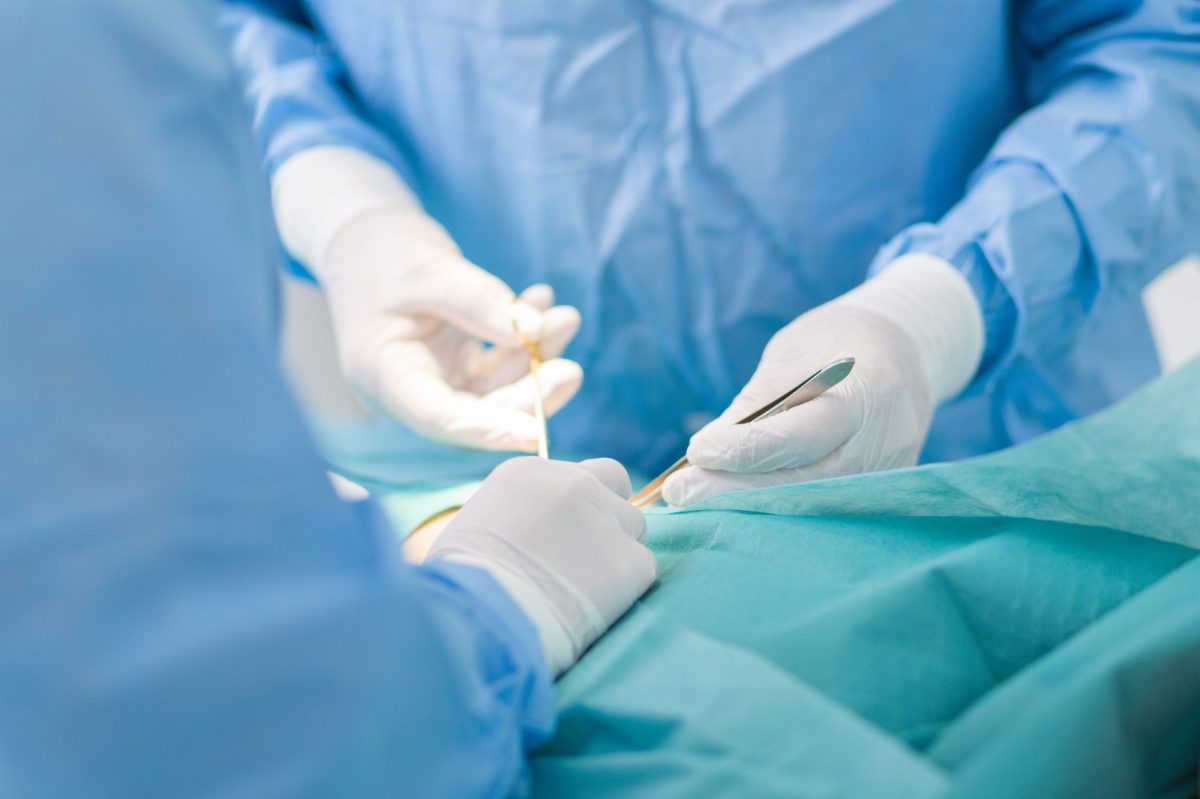 Nahaufnahme auf eine medizinische Operation. Menschen in blauen Kitteln und weißen Handschuhen halten Op-Werkzeuge